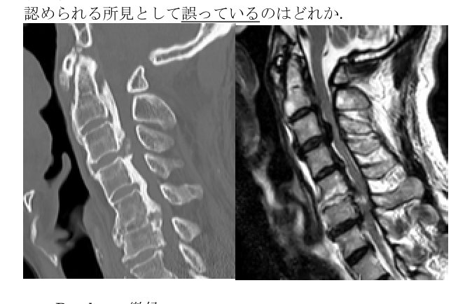 第38回問53 頚椎CT・MRI