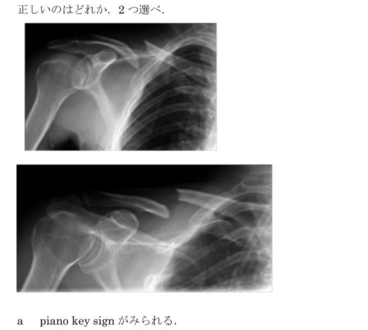 第38回問78 右鎖骨X線