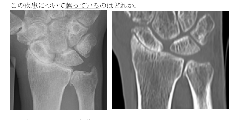 第38回問79 手関節X線・CT