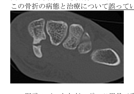 第38回問80 手関節CT横断像
